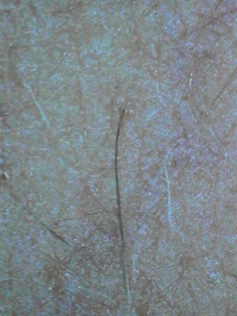Vista microscópica de la piel antes de del dermaplaning